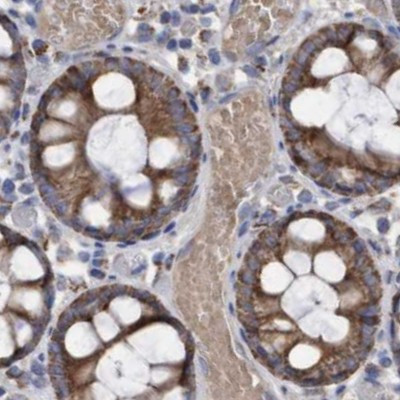 COBL Antibody in Immunohistochemistry (IHC)