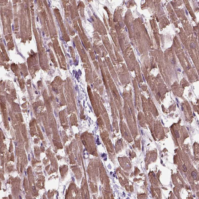 XK Antibody in Immunohistochemistry (IHC)