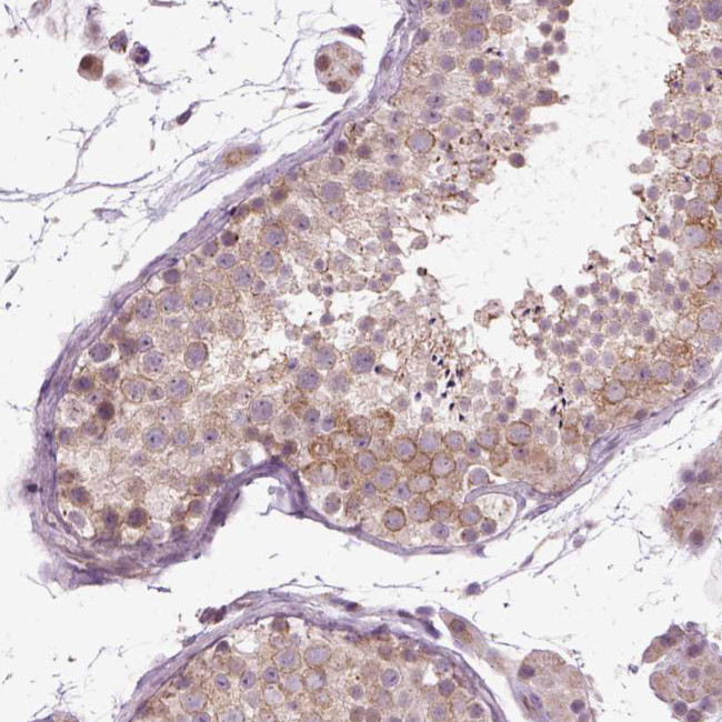 XK Antibody in Immunohistochemistry (IHC)