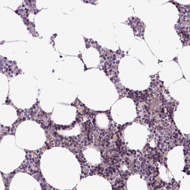 XK Antibody in Immunohistochemistry (IHC)