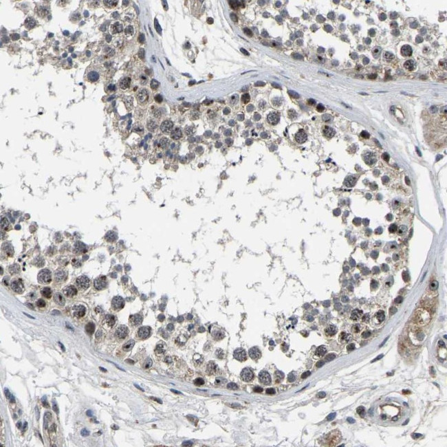 RBM28 Antibody in Immunohistochemistry (IHC)