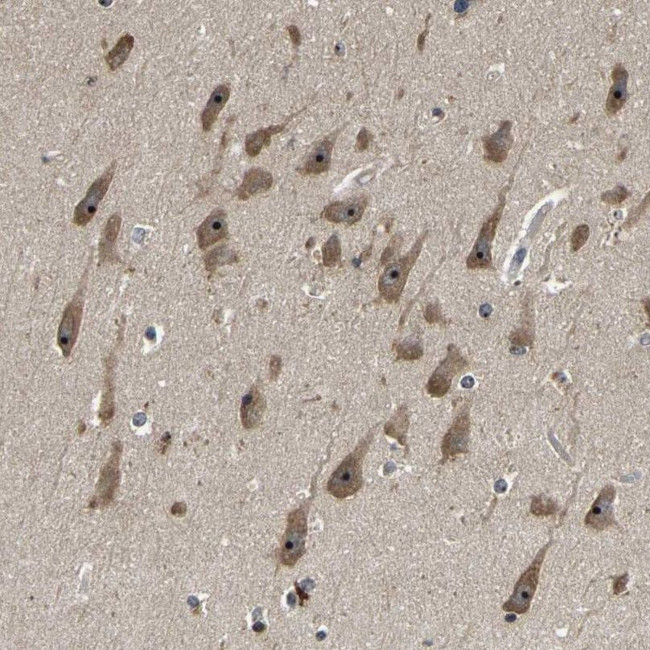 RBM28 Antibody in Immunohistochemistry (IHC)