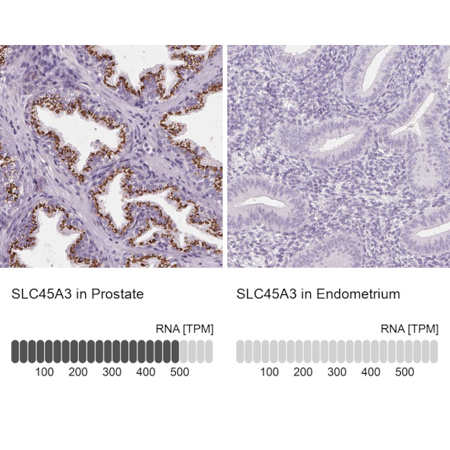 Prostein Antibody in Immunohistochemistry (IHC)