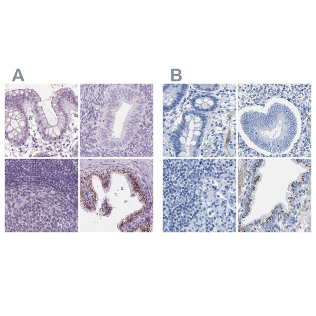 Prostein Antibody in Immunohistochemistry (IHC)