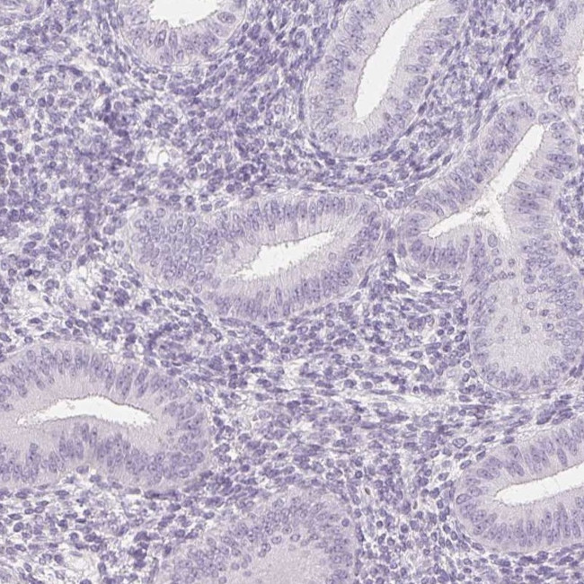 Prostein Antibody in Immunohistochemistry (IHC)