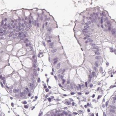 Prostein Antibody in Immunohistochemistry (IHC)