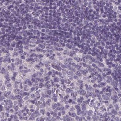 Prostein Antibody in Immunohistochemistry (IHC)