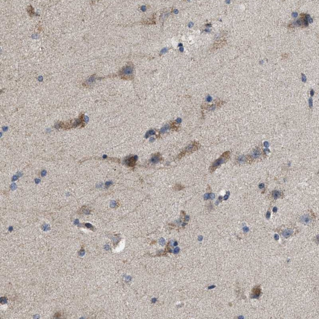 PDP1 Antibody in Immunohistochemistry (IHC)