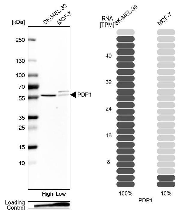 PDP1 Antibody in Western Blot (WB)