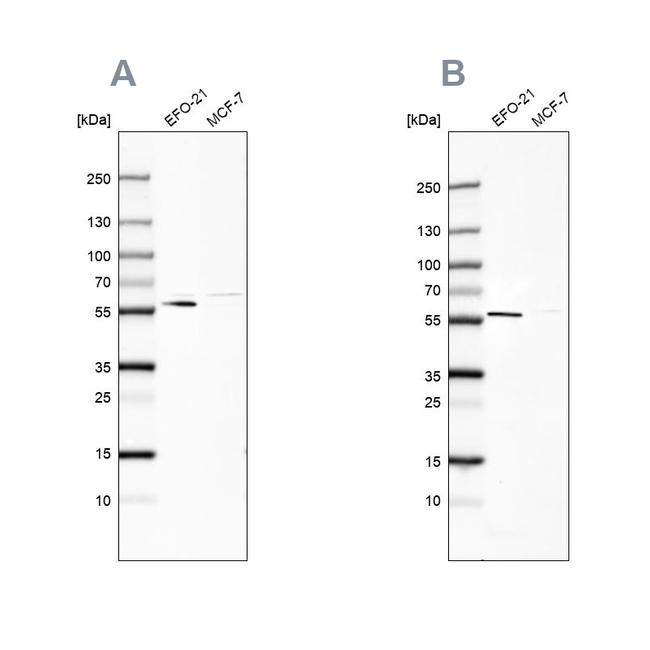 PDP1 Antibody in Western Blot (WB)