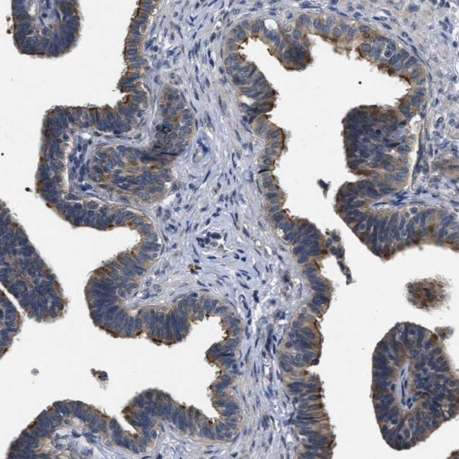 IFT81 Antibody in Immunohistochemistry (IHC)