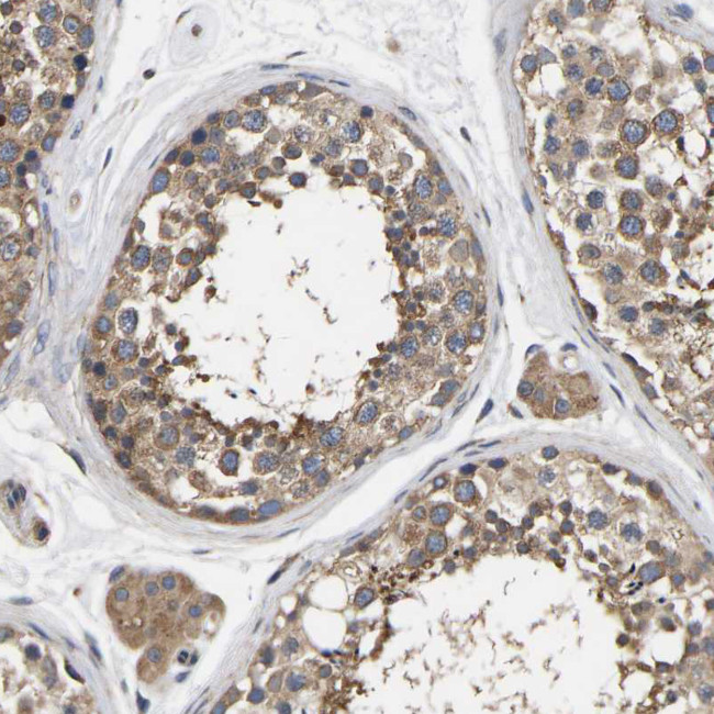 JTV-1 Antibody in Immunohistochemistry (IHC)