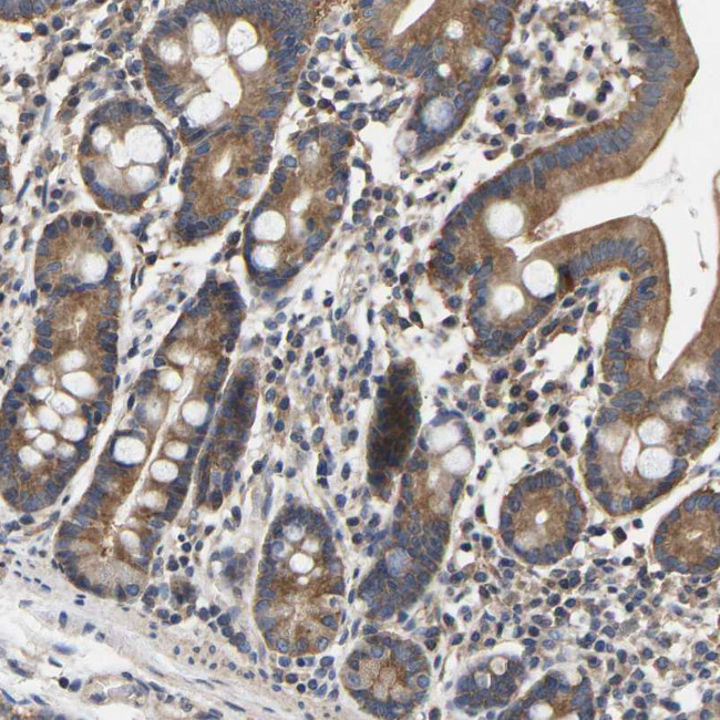 JTV-1 Antibody in Immunohistochemistry (IHC)