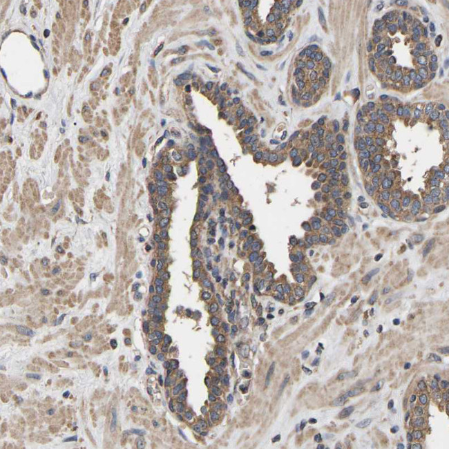 JTV-1 Antibody in Immunohistochemistry (IHC)