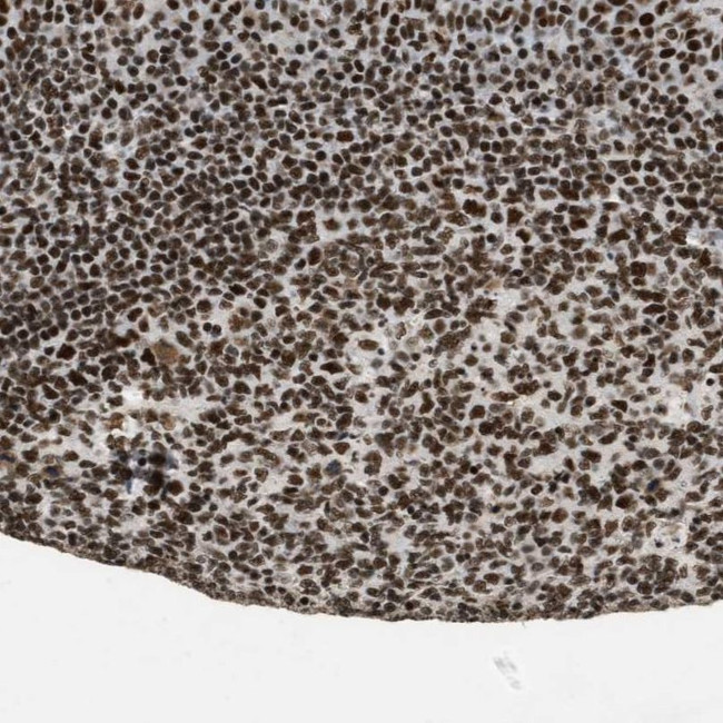 SMARCB1 Antibody in Immunohistochemistry (IHC)