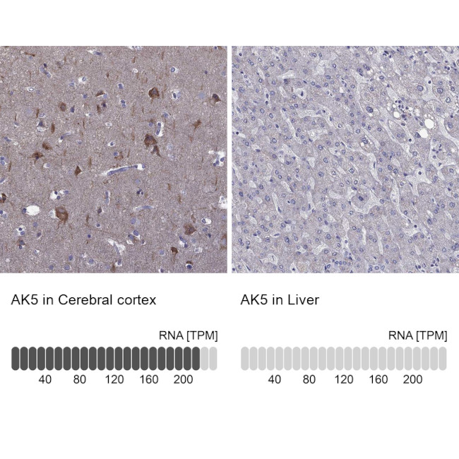 Adenylate Kinase 5 Antibody in Immunohistochemistry (IHC)