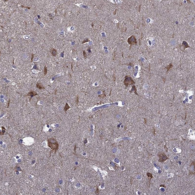 Adenylate Kinase 5 Antibody in Immunohistochemistry (IHC)