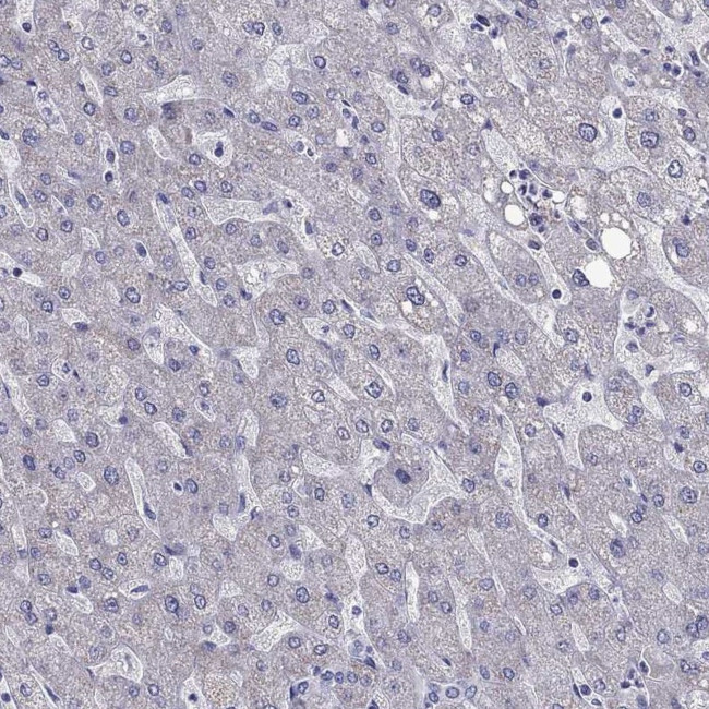 Adenylate Kinase 5 Antibody in Immunohistochemistry (IHC)