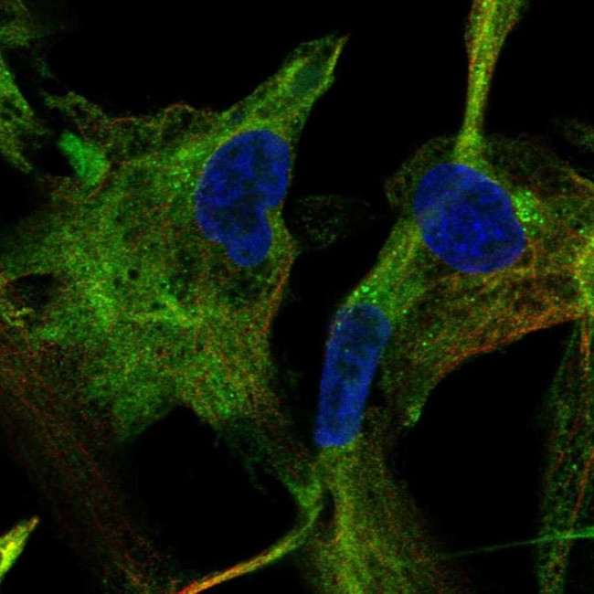 Adenylate Kinase 5 Antibody in Immunocytochemistry (ICC/IF)