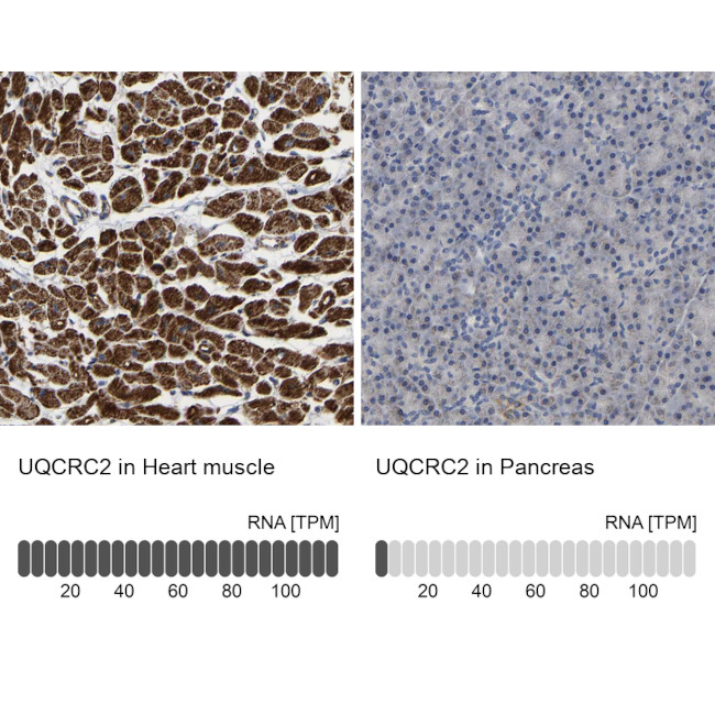 UQCRC2 Antibody in Immunohistochemistry (IHC)