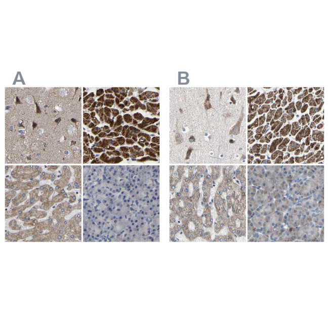 UQCRC2 Antibody in Immunohistochemistry (IHC)