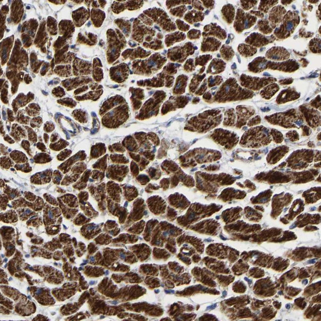 UQCRC2 Antibody in Immunohistochemistry (IHC)