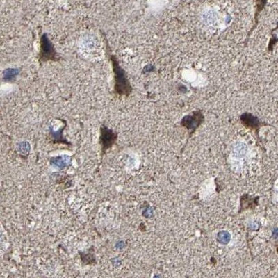 UQCRC2 Antibody in Immunohistochemistry (IHC)