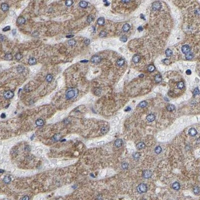 UQCRC2 Antibody in Immunohistochemistry (IHC)