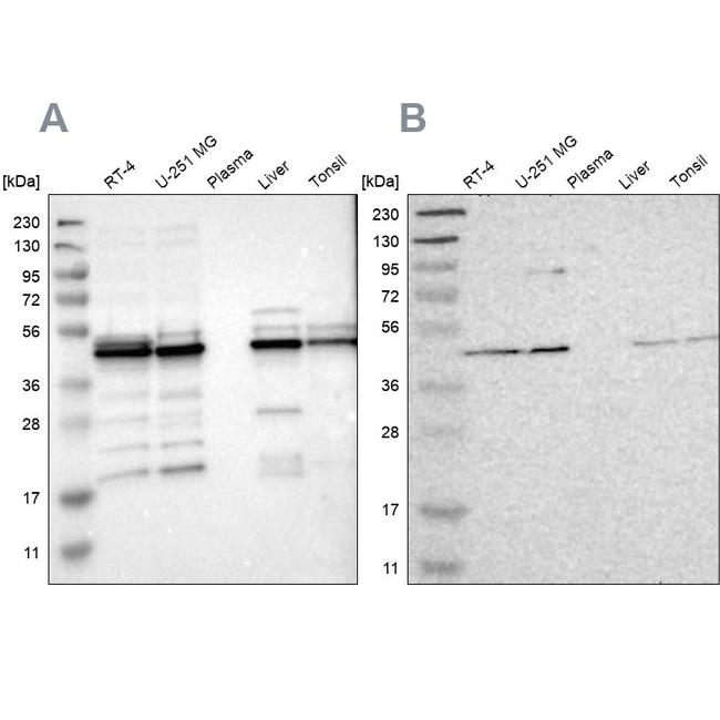 UQCRC2 Antibody in Western Blot (WB)