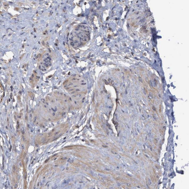 COBL Antibody in Immunohistochemistry (IHC)