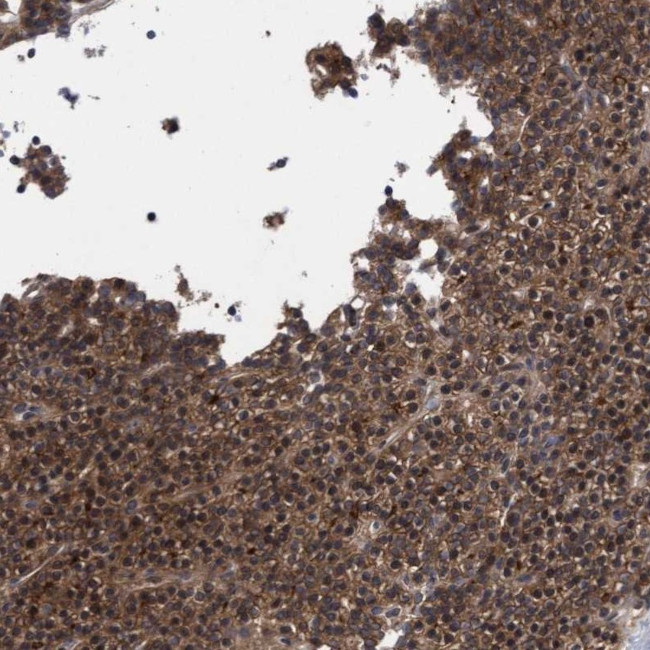 COBL Antibody in Immunohistochemistry (IHC)