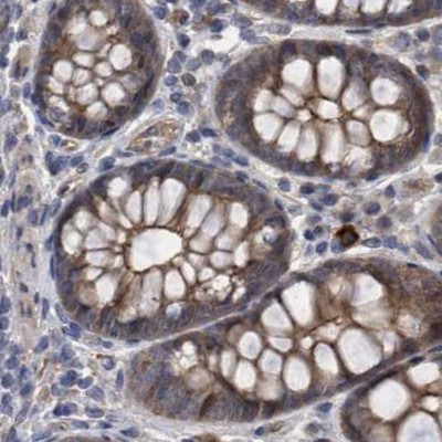 COBL Antibody in Immunohistochemistry (IHC)