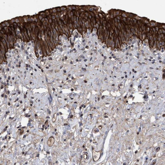 COBL Antibody in Immunohistochemistry (IHC)