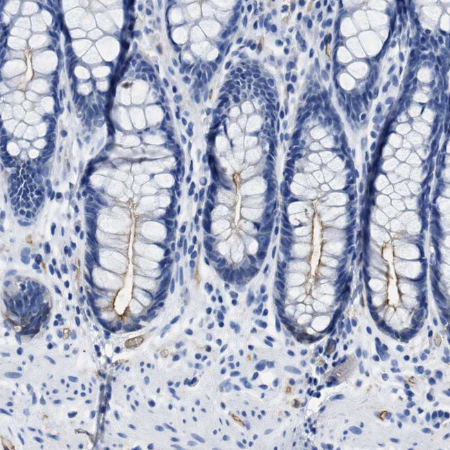 Aquaporin 1 Antibody in Immunohistochemistry (IHC)