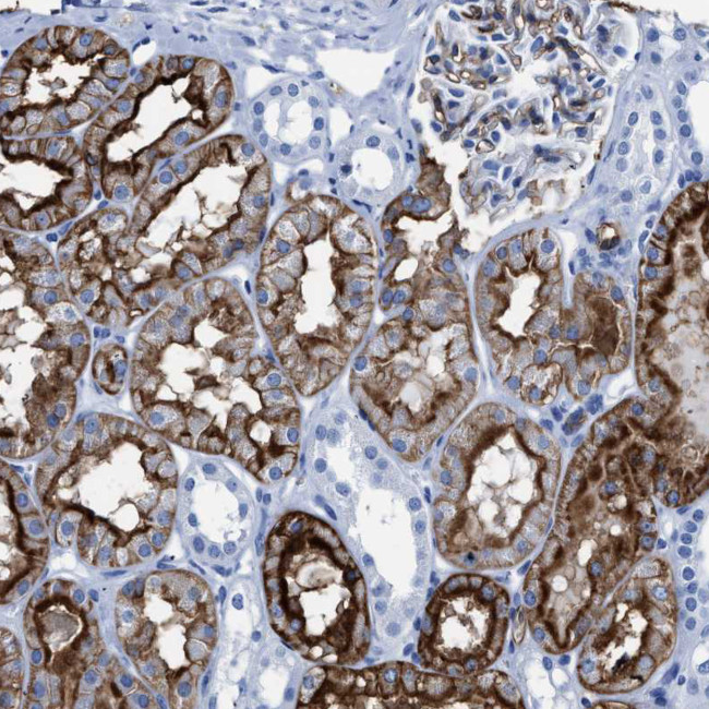 Aquaporin 1 Antibody in Immunohistochemistry (IHC)