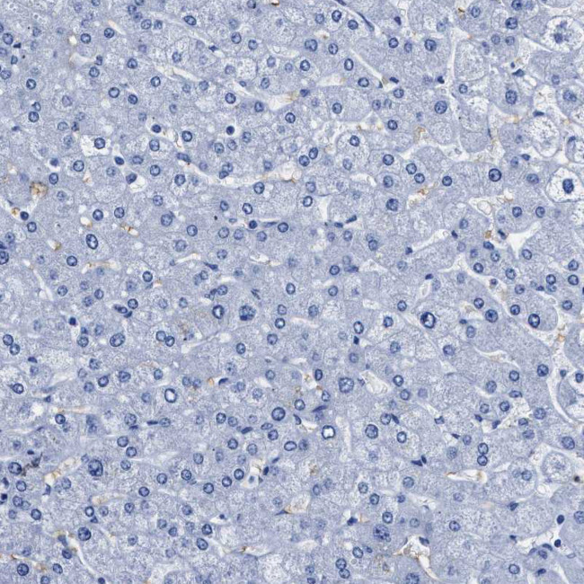 Aquaporin 1 Antibody in Immunohistochemistry (IHC)