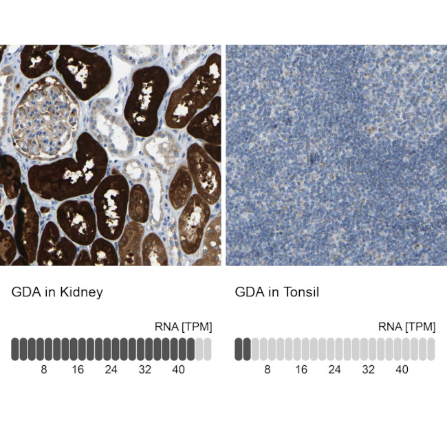 GDA Antibody in Immunohistochemistry (IHC)