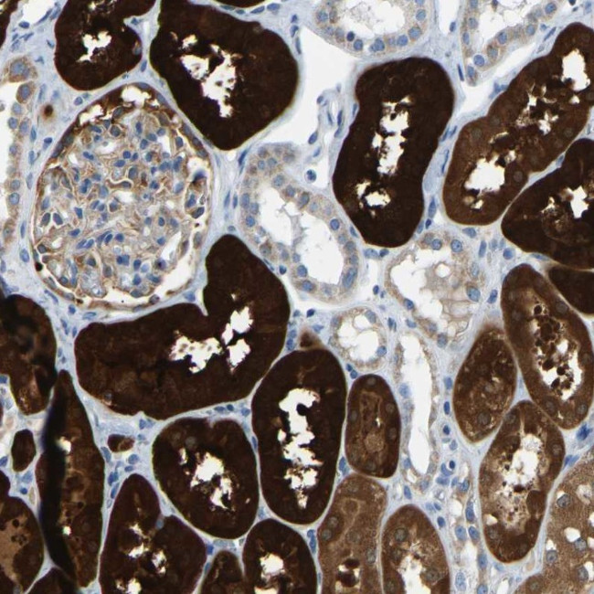 GDA Antibody in Immunohistochemistry (IHC)