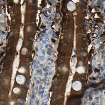 GDA Antibody in Immunohistochemistry (IHC)