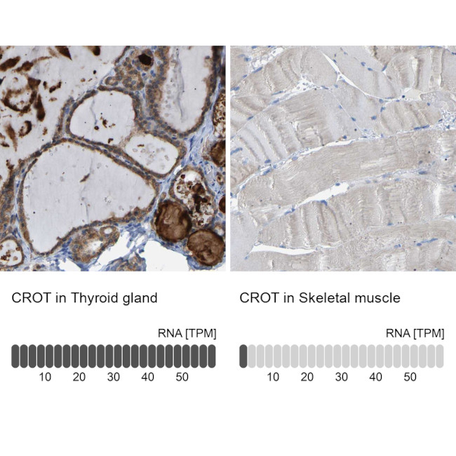 CROT Antibody in Immunohistochemistry (IHC)