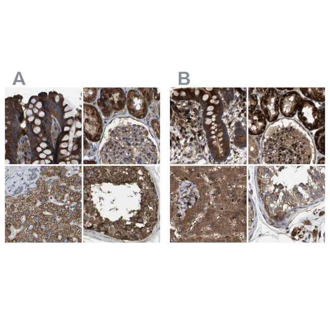 GCC1 Antibody in Immunohistochemistry (IHC)