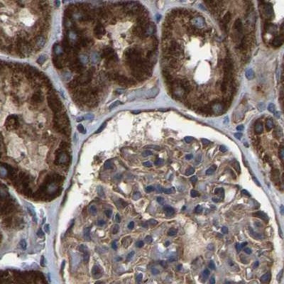 GCC1 Antibody in Immunohistochemistry (IHC)