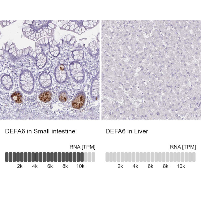 Defensin 6 Antibody in Immunohistochemistry (IHC)