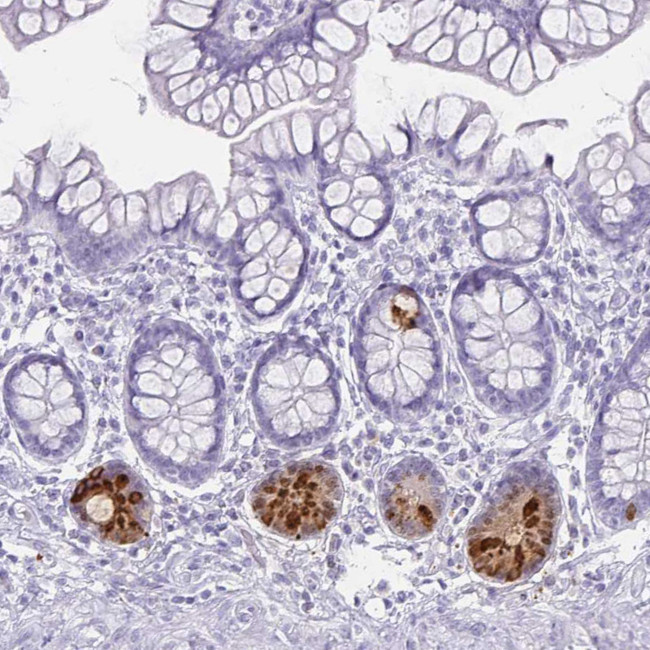 Defensin 6 Antibody in Immunohistochemistry (IHC)