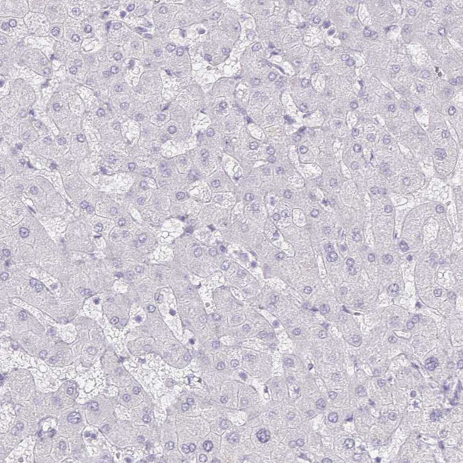 Defensin 6 Antibody in Immunohistochemistry (IHC)