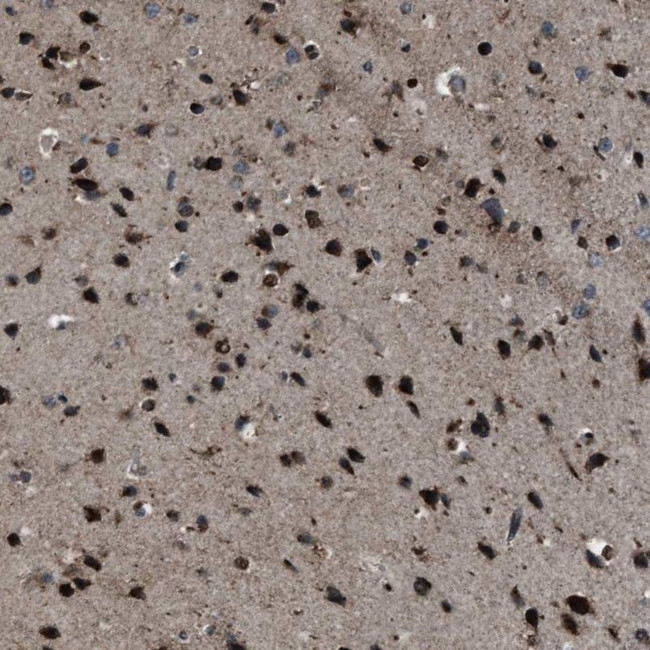 ZFAND2A Antibody in Immunohistochemistry (IHC)