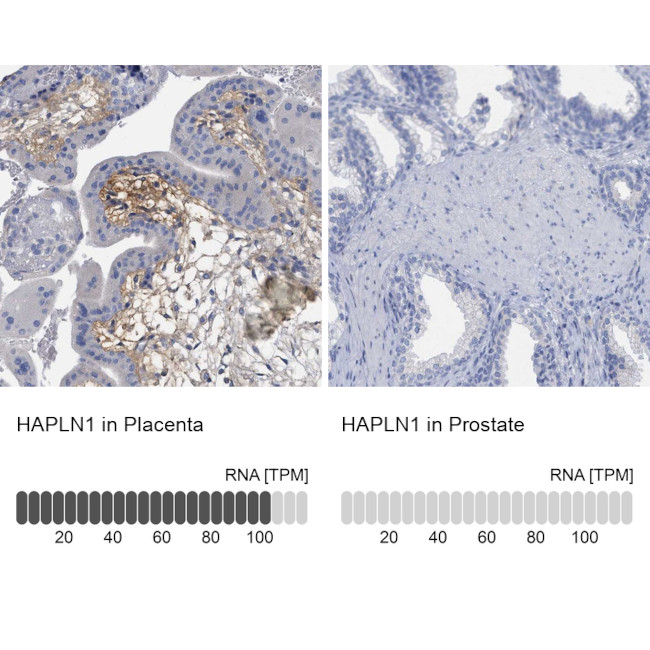 HAPLN1 Antibody in Immunohistochemistry (IHC)