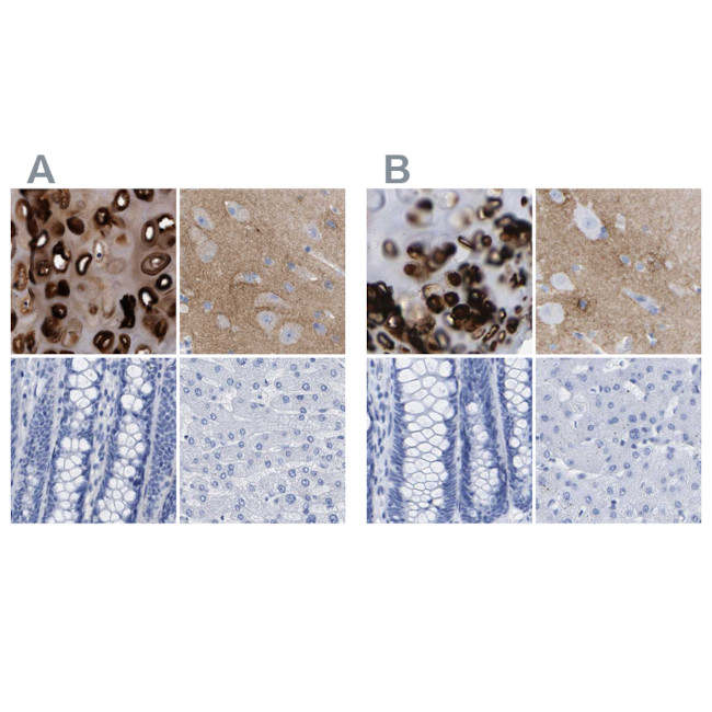 HAPLN1 Antibody in Immunohistochemistry (IHC)