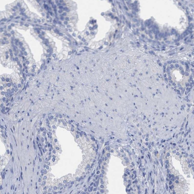 HAPLN1 Antibody in Immunohistochemistry (IHC)