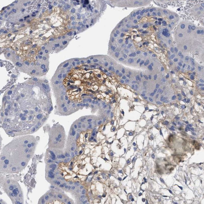 HAPLN1 Antibody in Immunohistochemistry (IHC)